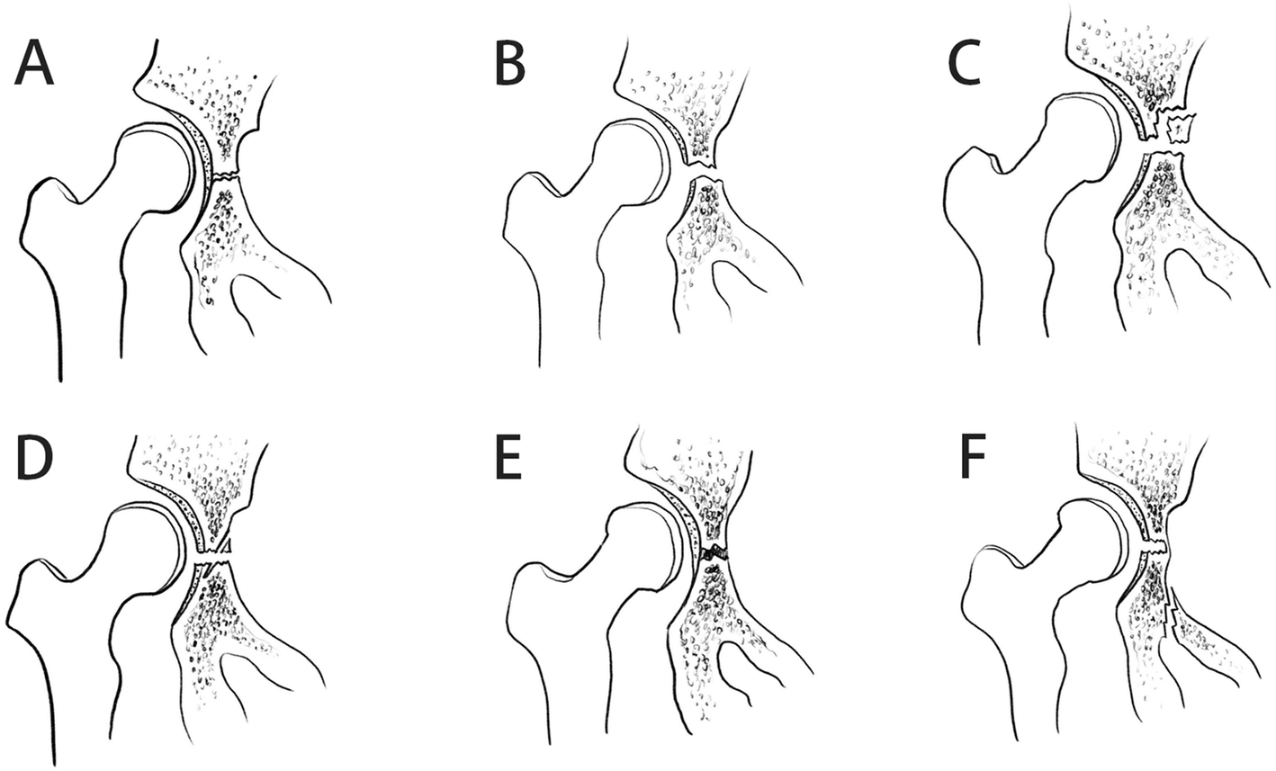 Fig. 5