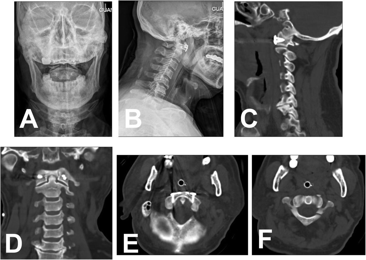 Fig. 6