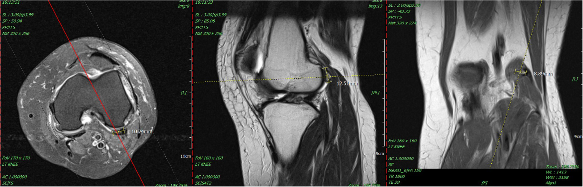 Fig. 3