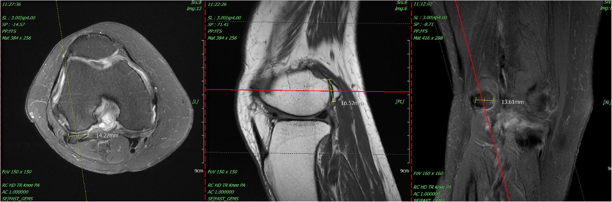 Fig. 4