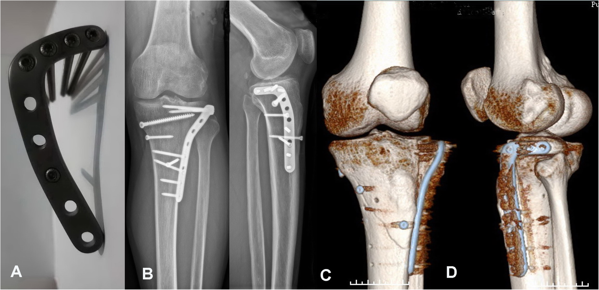 Fig. 3