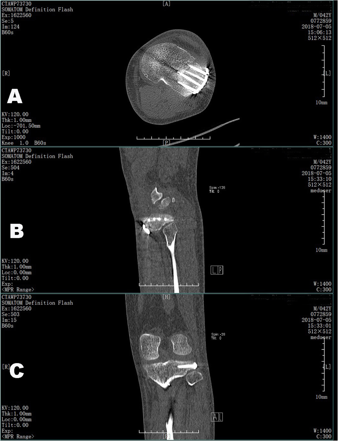 Fig. 4