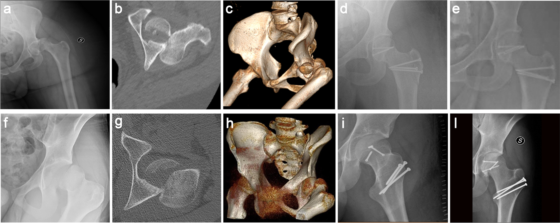 Fig. 1