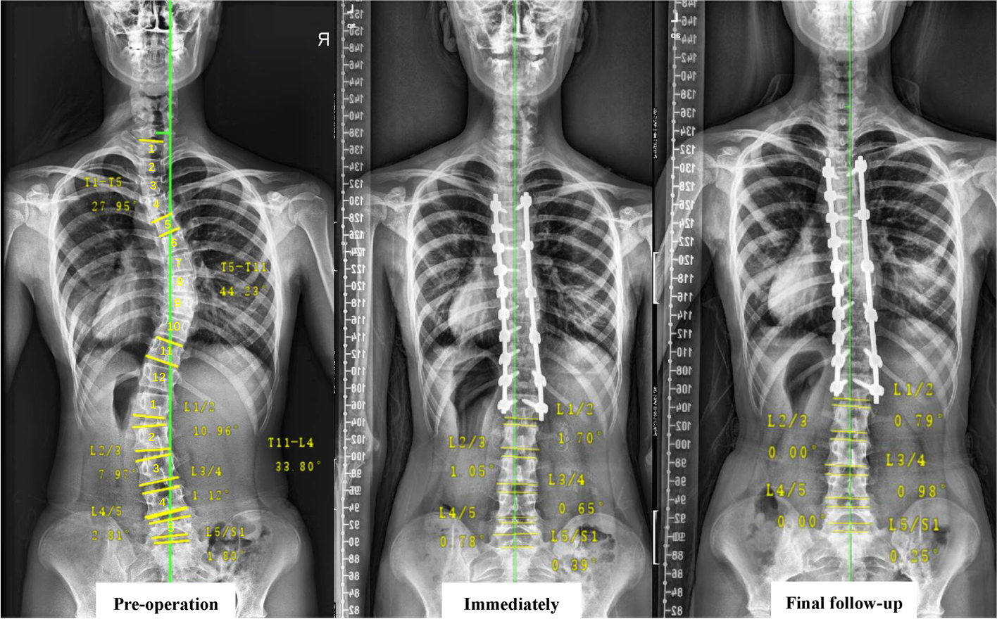 Fig. 3