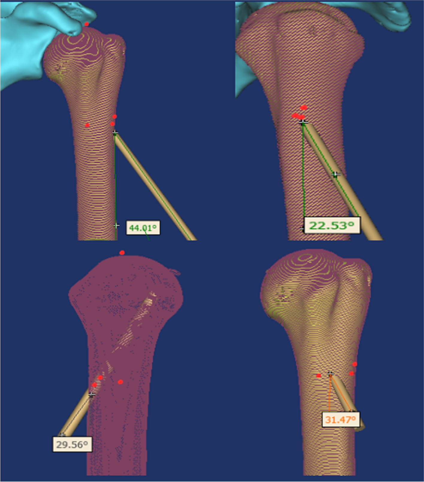 Fig. 4