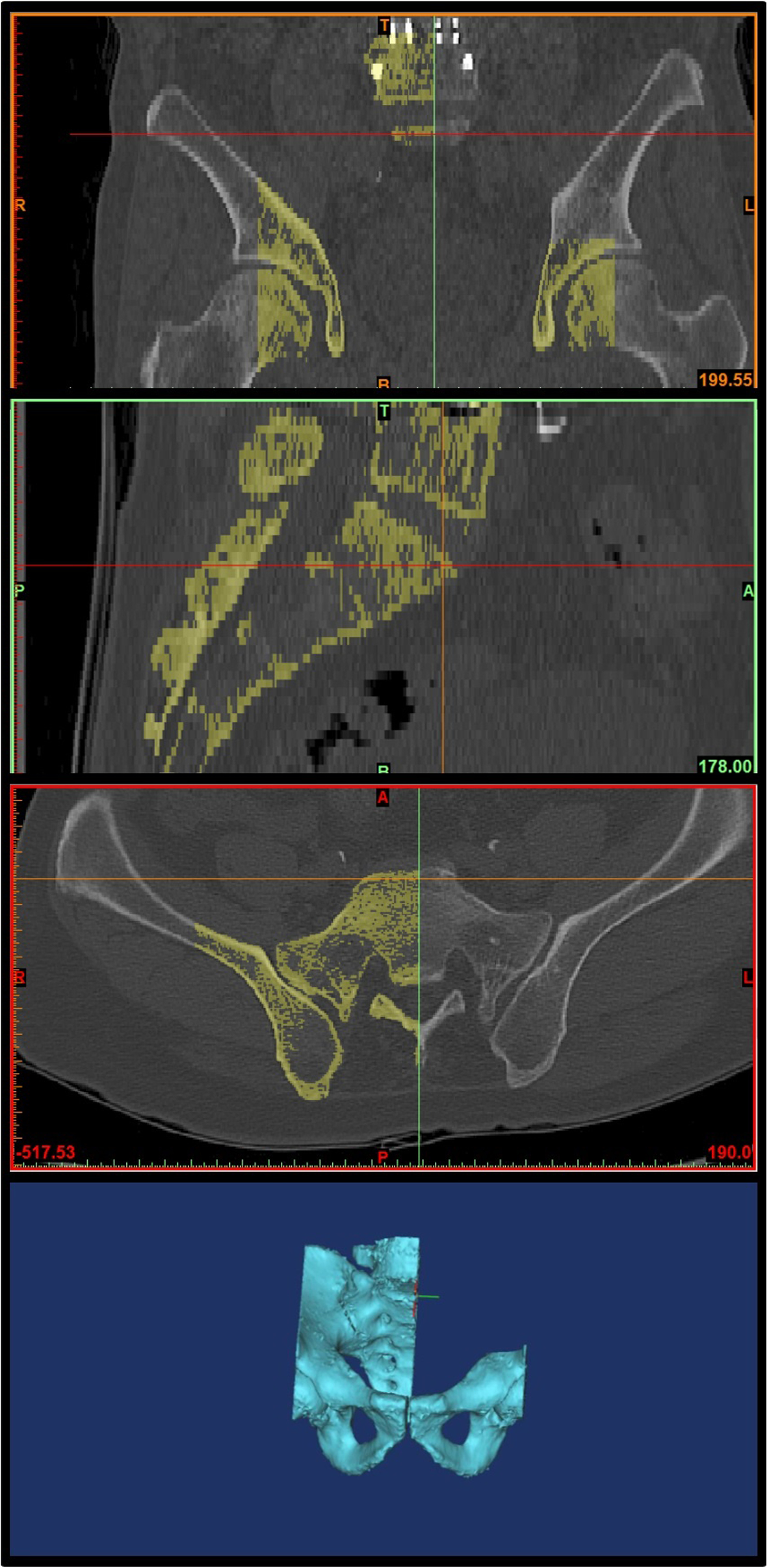 Fig. 3