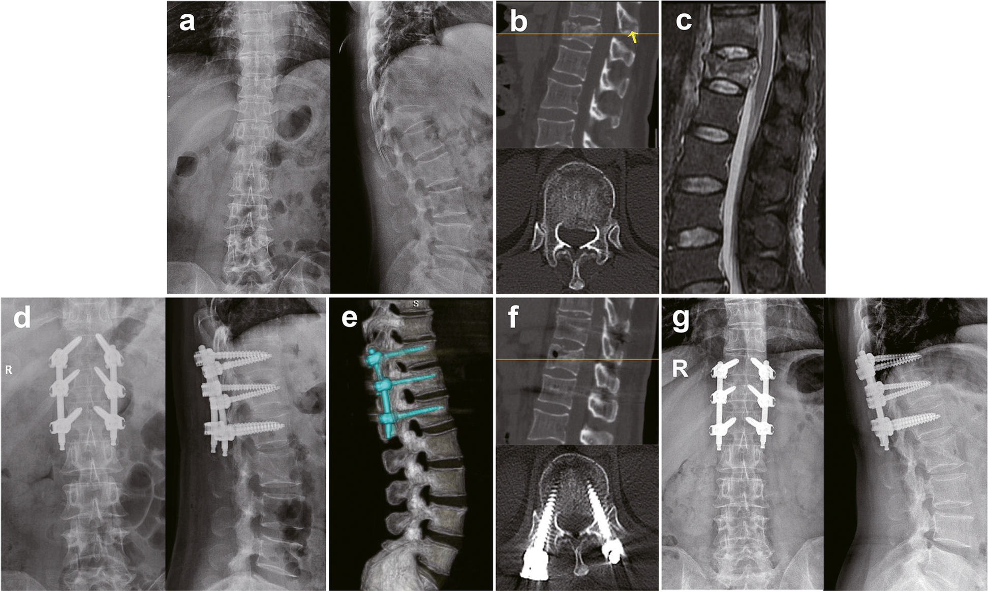 Fig. 4