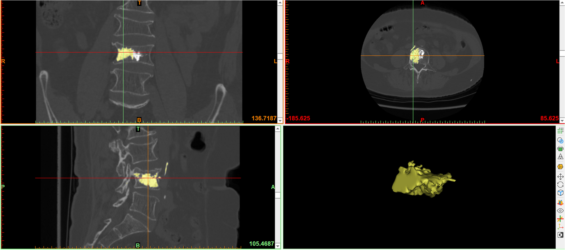 Fig. 2