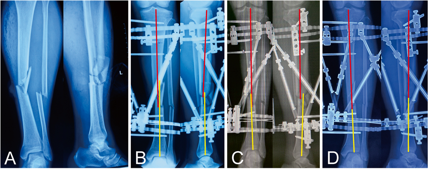 Fig. 3