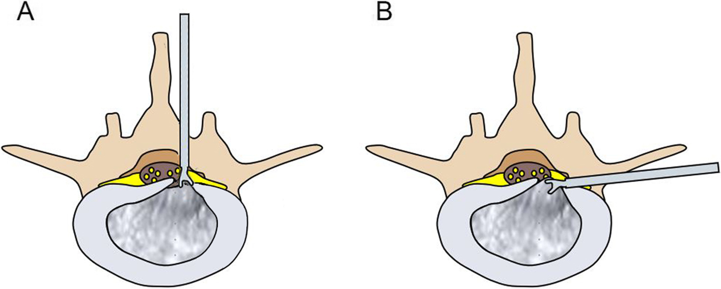 Fig.1