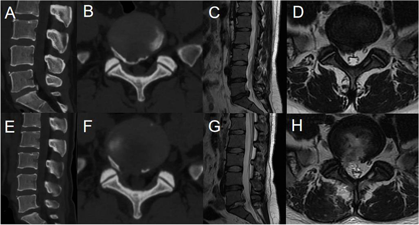 Fig.3