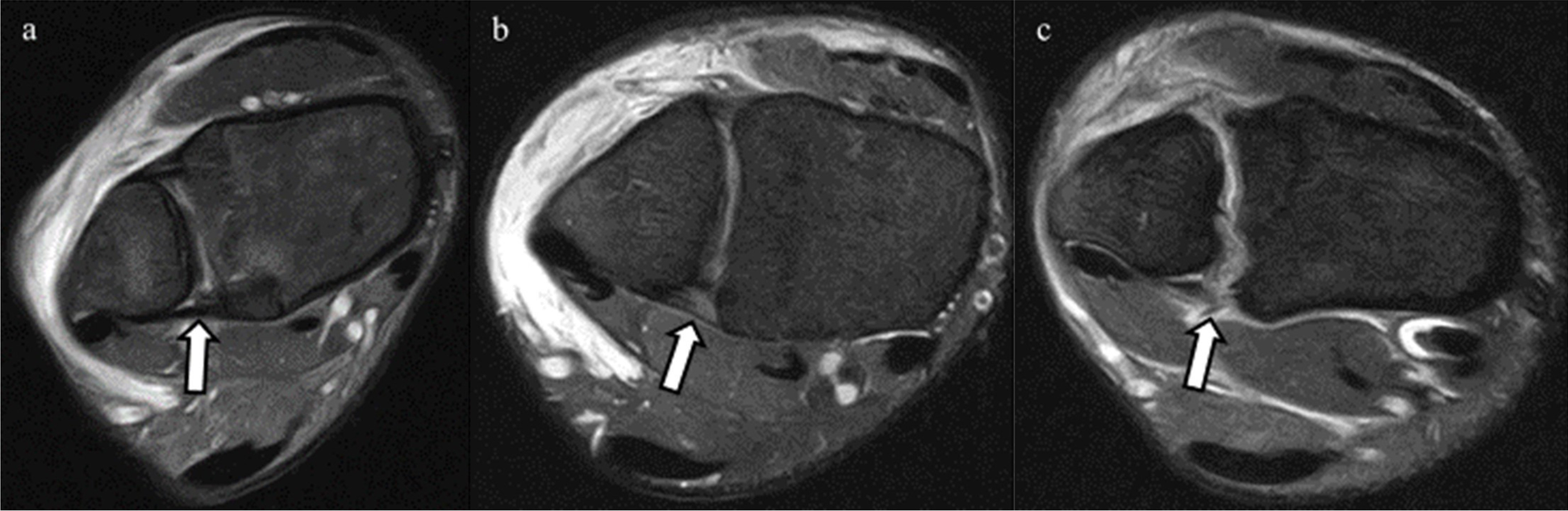 Fig. 7