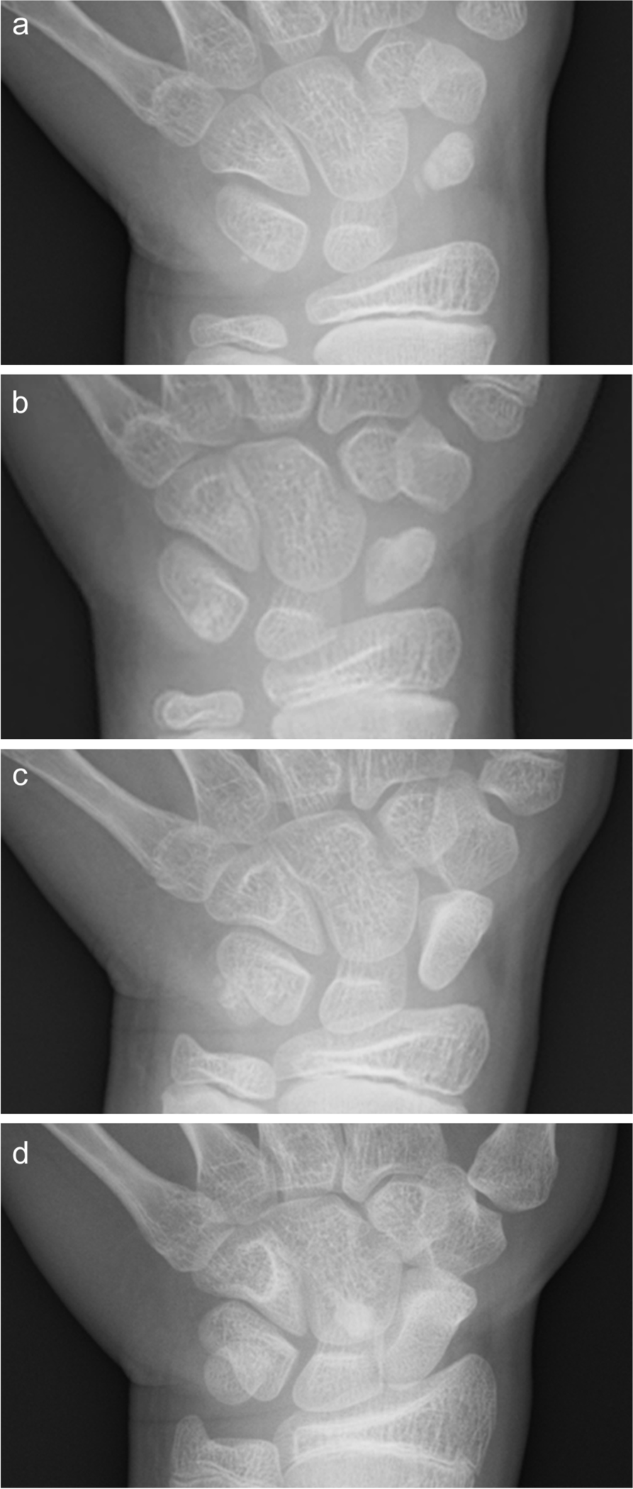 Fig. 2