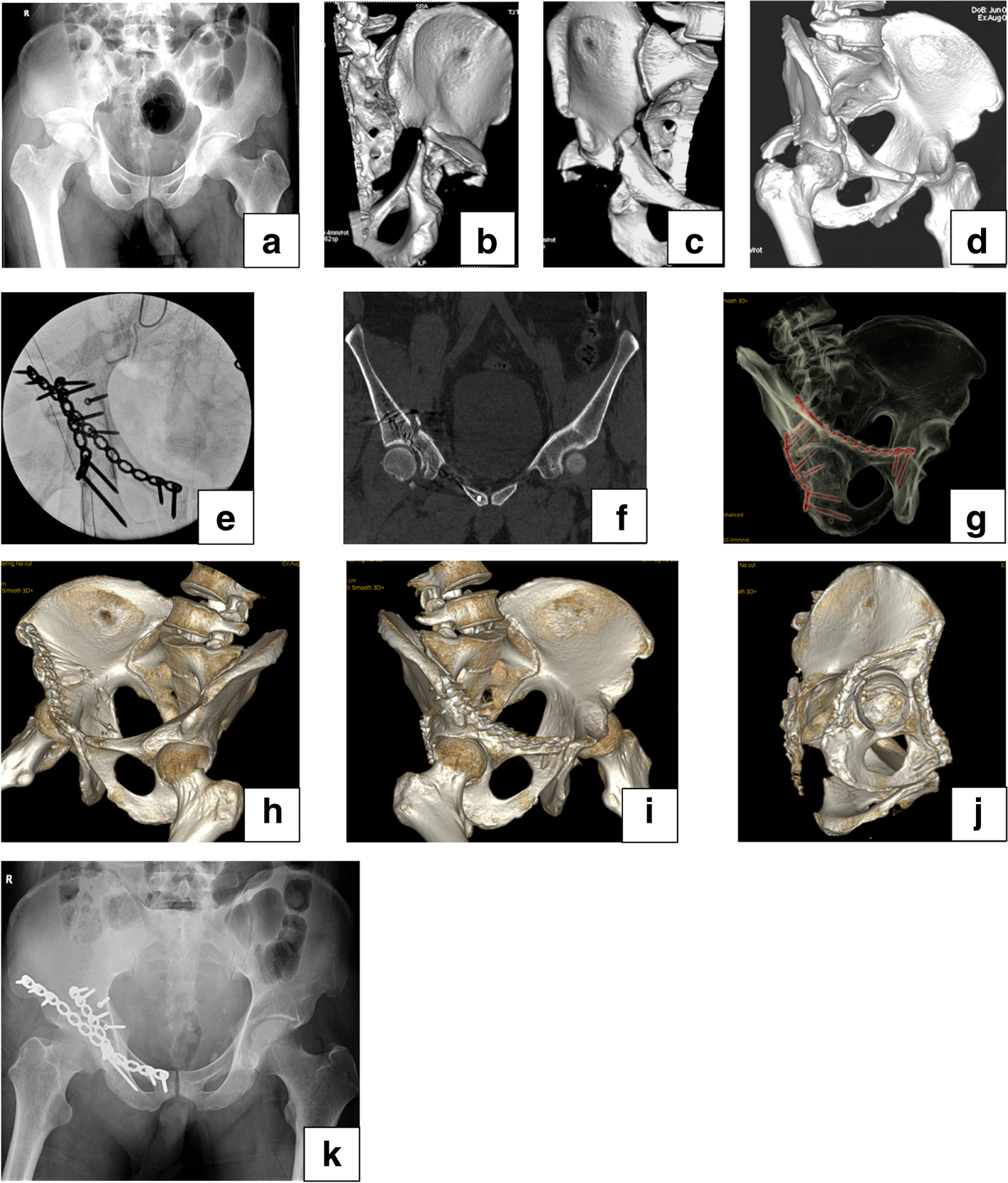 Fig. 6