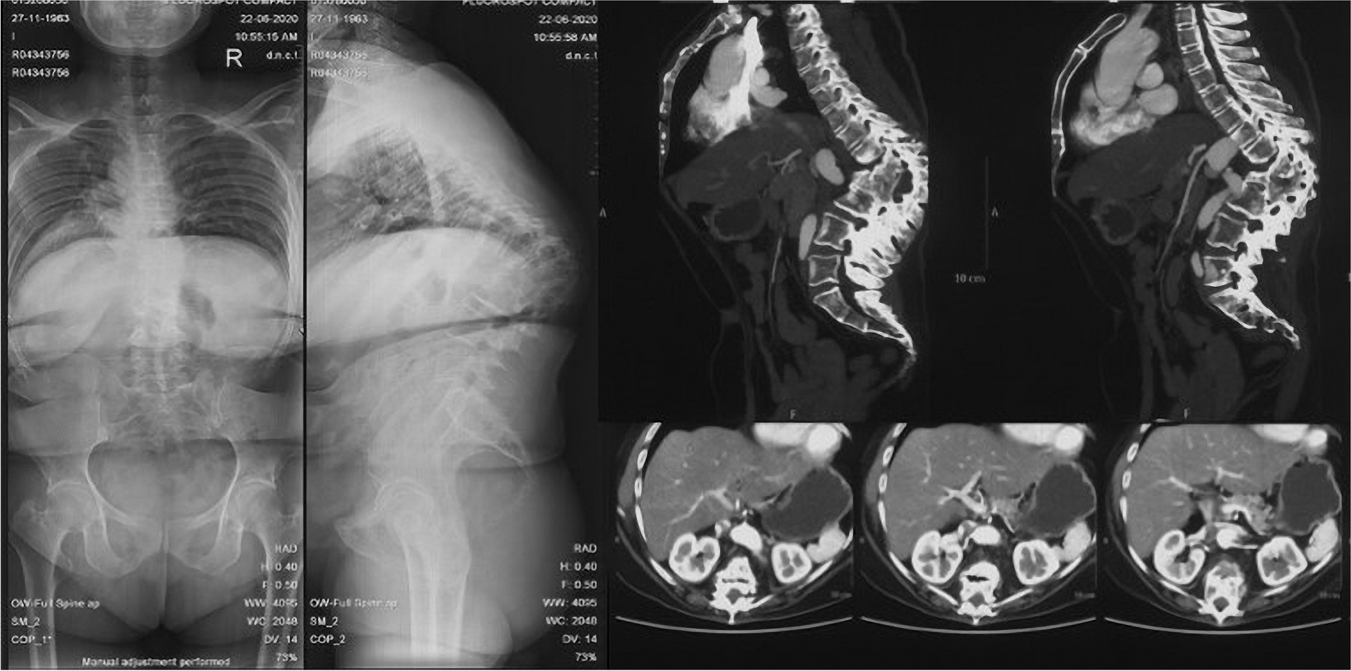 Fig. 10