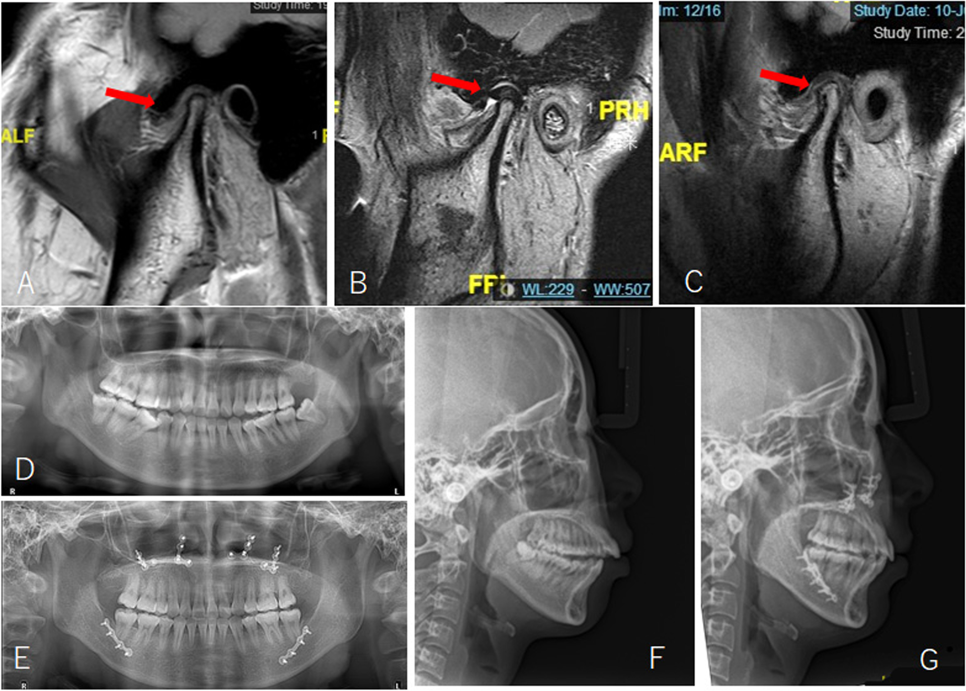 Fig. 10