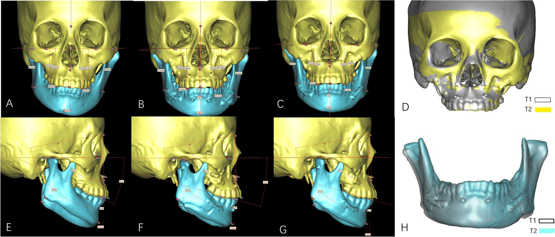 Fig. 7