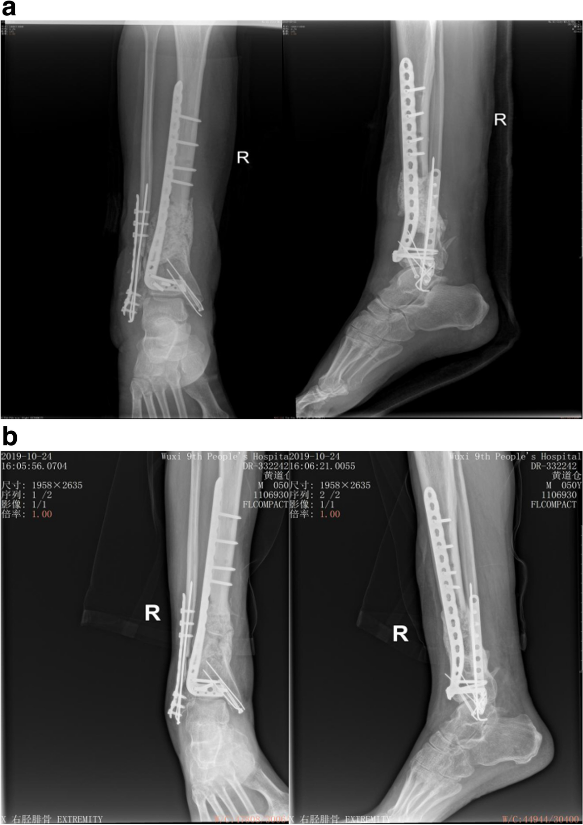 Fig. 4