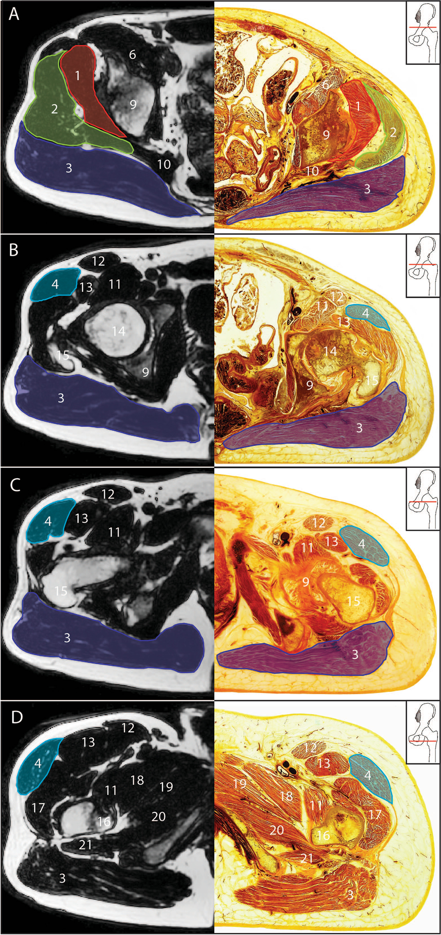 Fig. 4