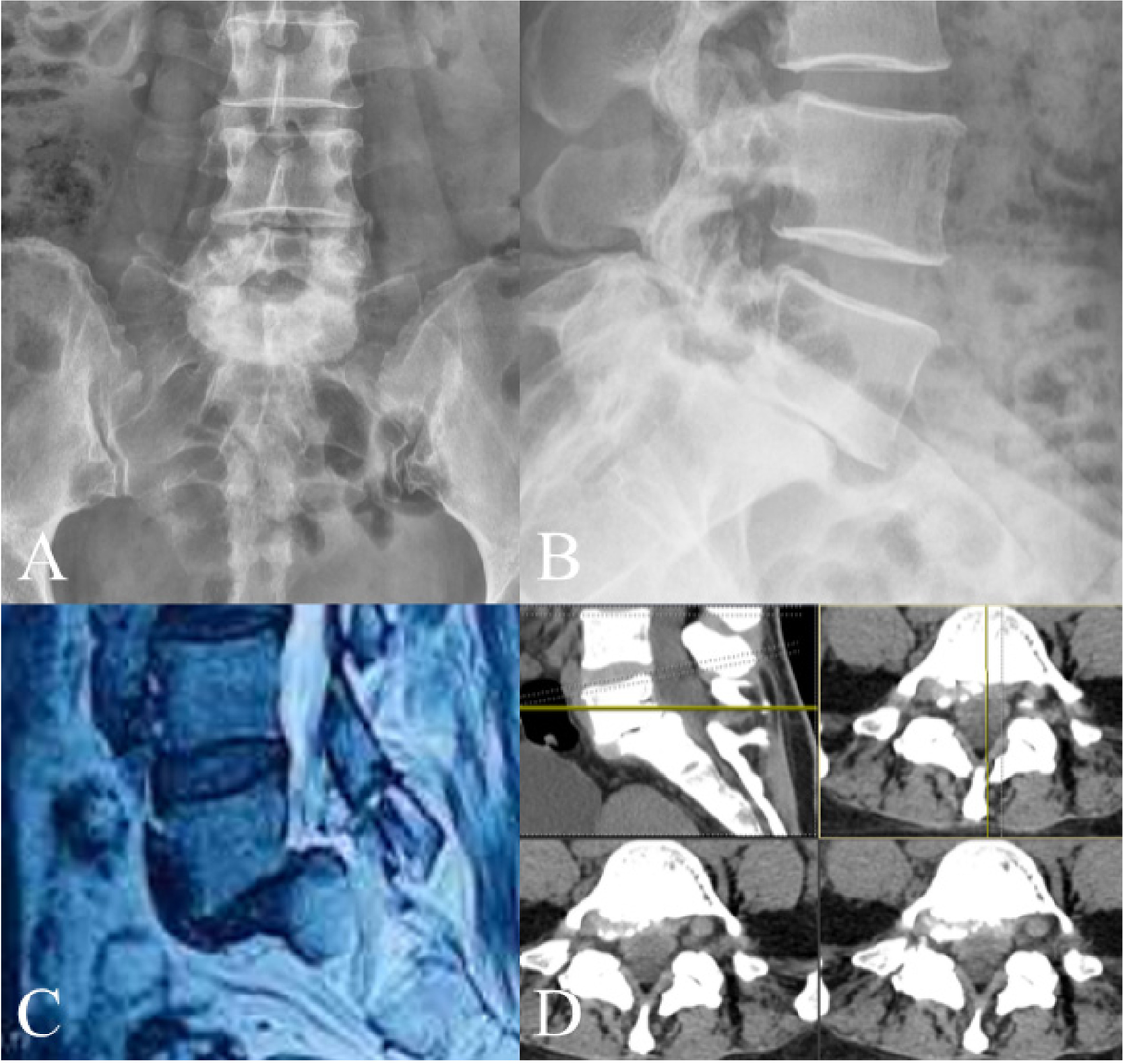 Fig. 1