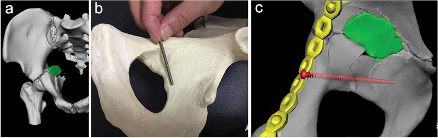 Fig. 4