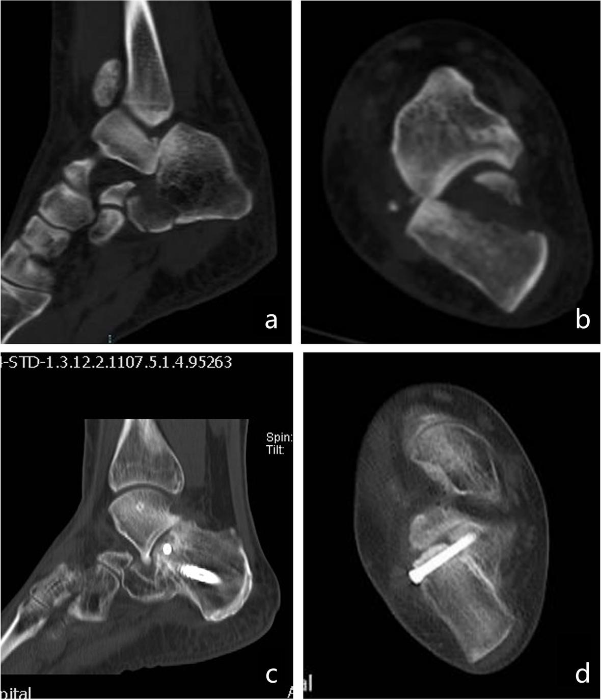 Fig. 8