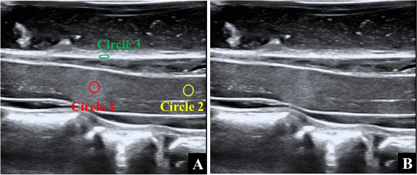 Fig.1