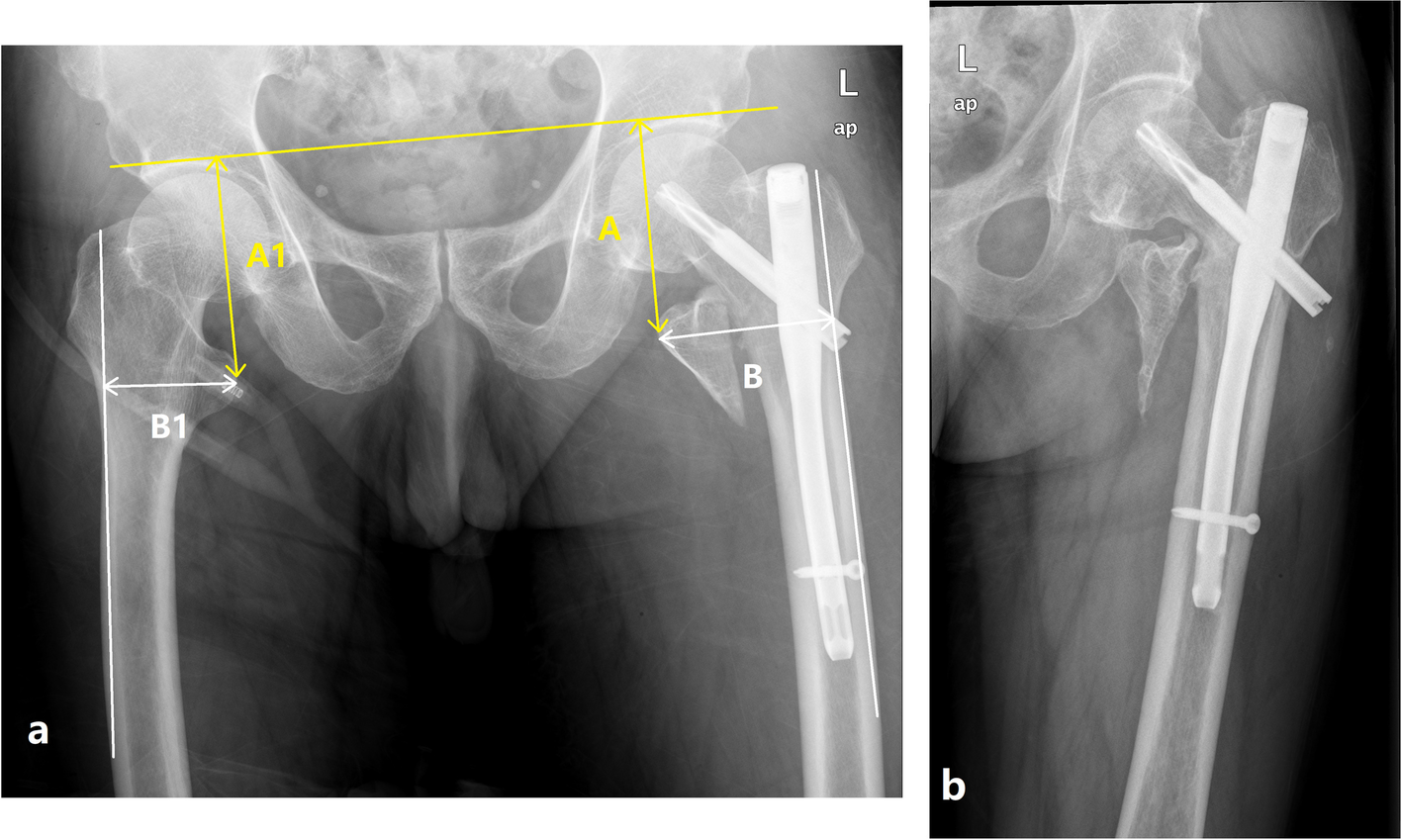 Fig. 1