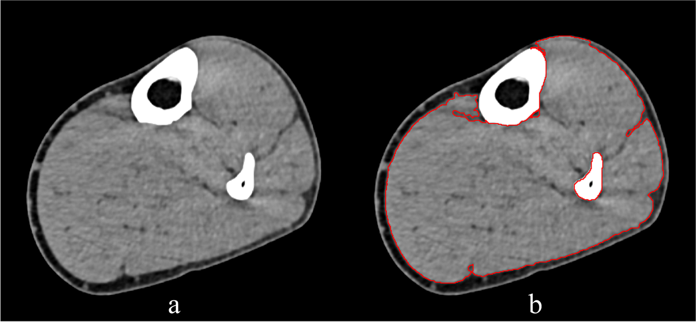 Fig. 4