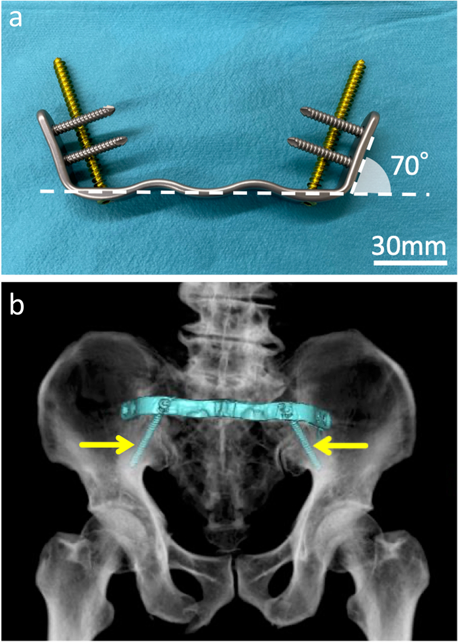 Fig. 1