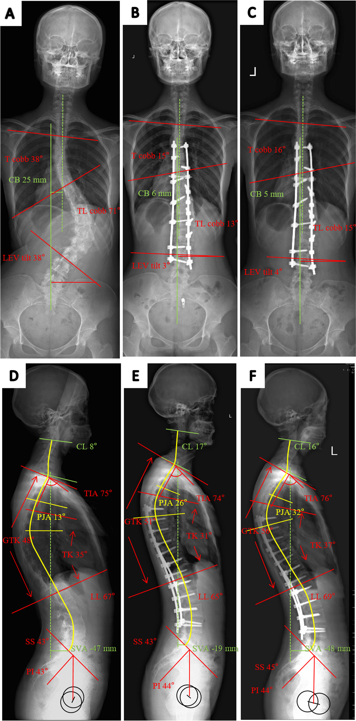 Fig. 4