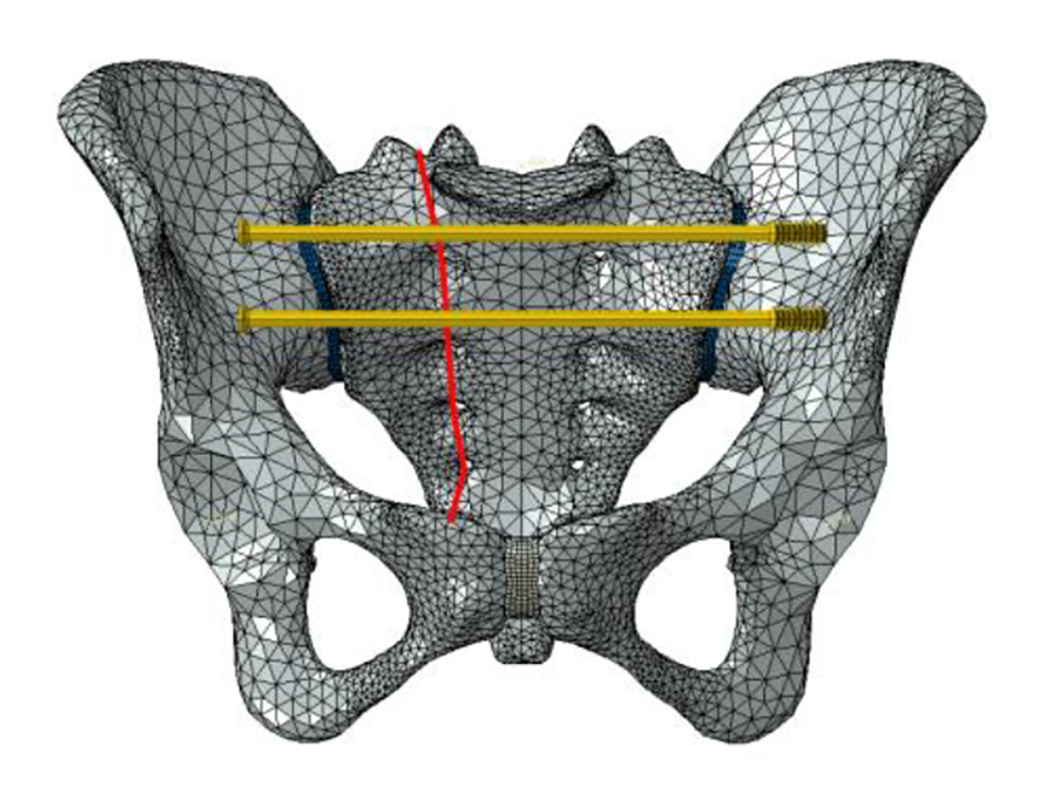 Fig. 4