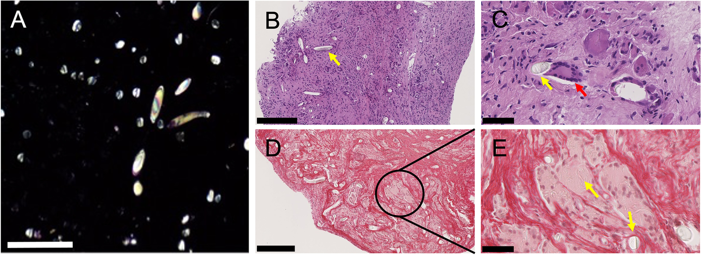 Fig. 4