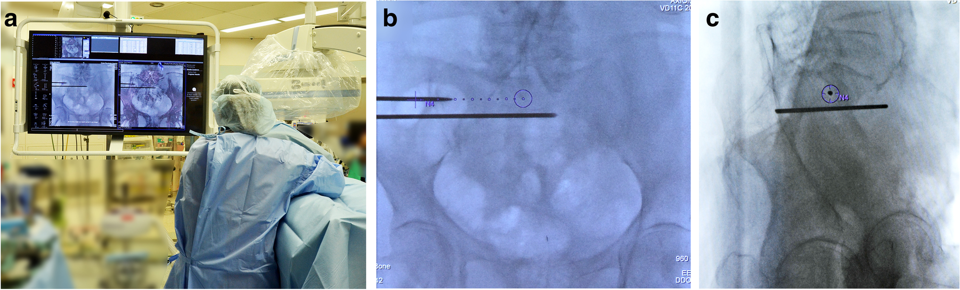 Fig. 4