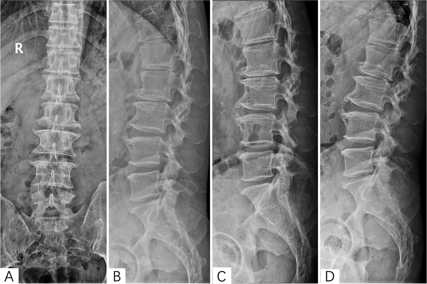 Fig. 1