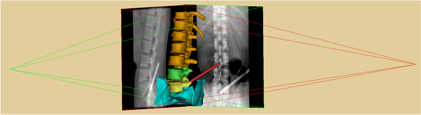 Fig. 3