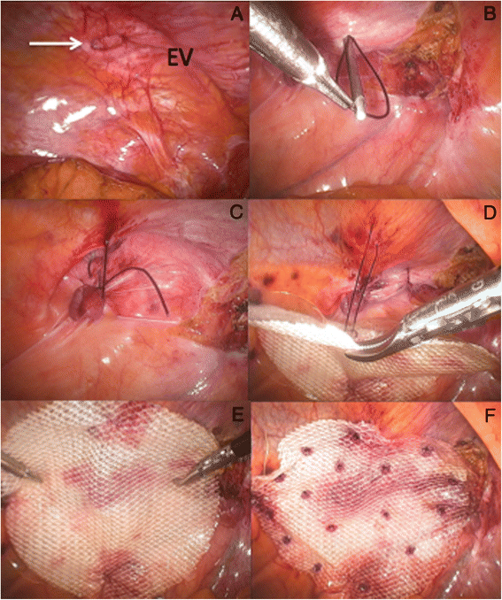 Fig. 13