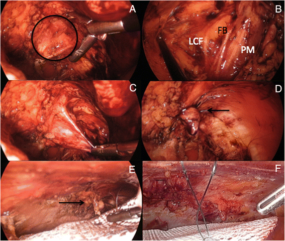 Fig. 14