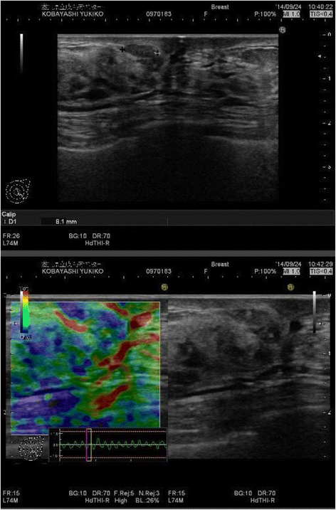 Fig. 2