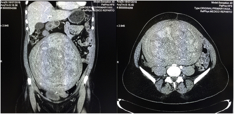 Fig. 2