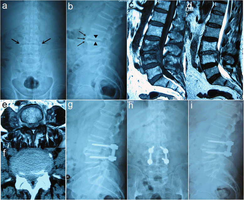 Fig.2