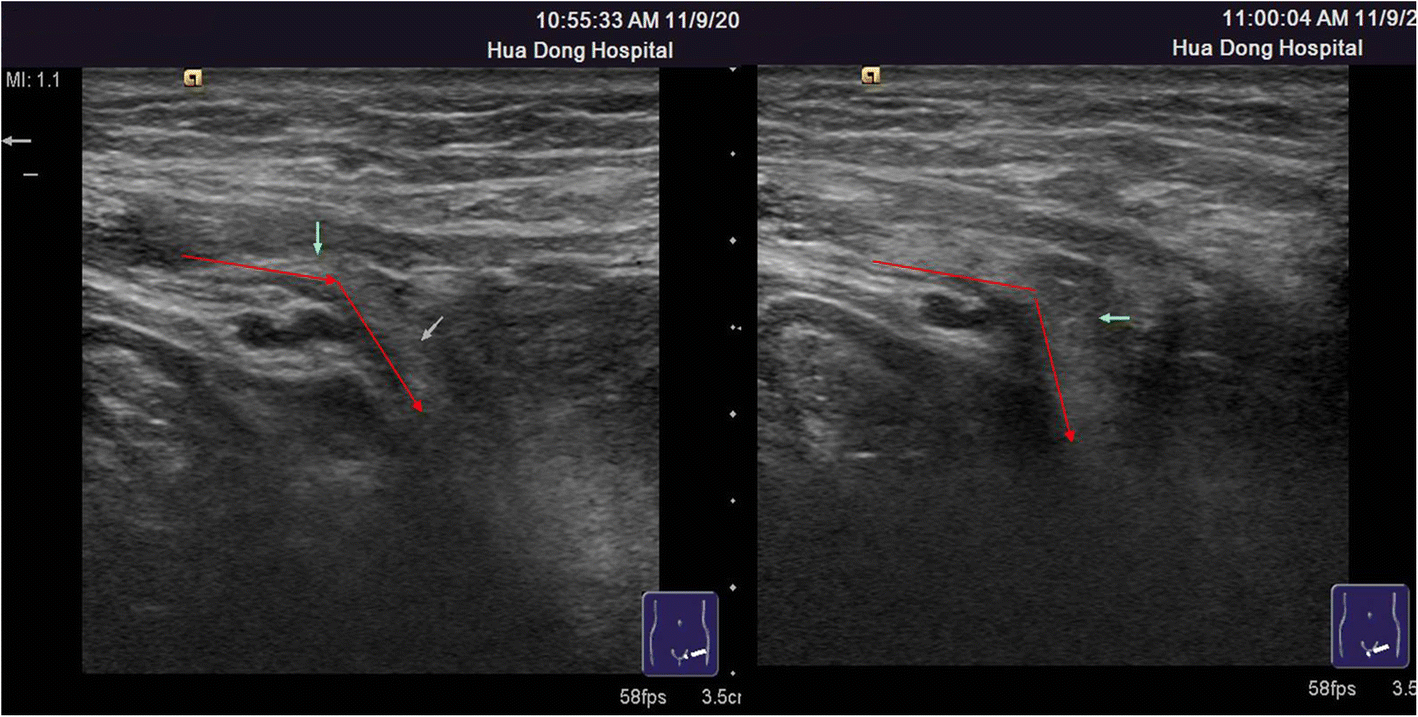 Fig. 7