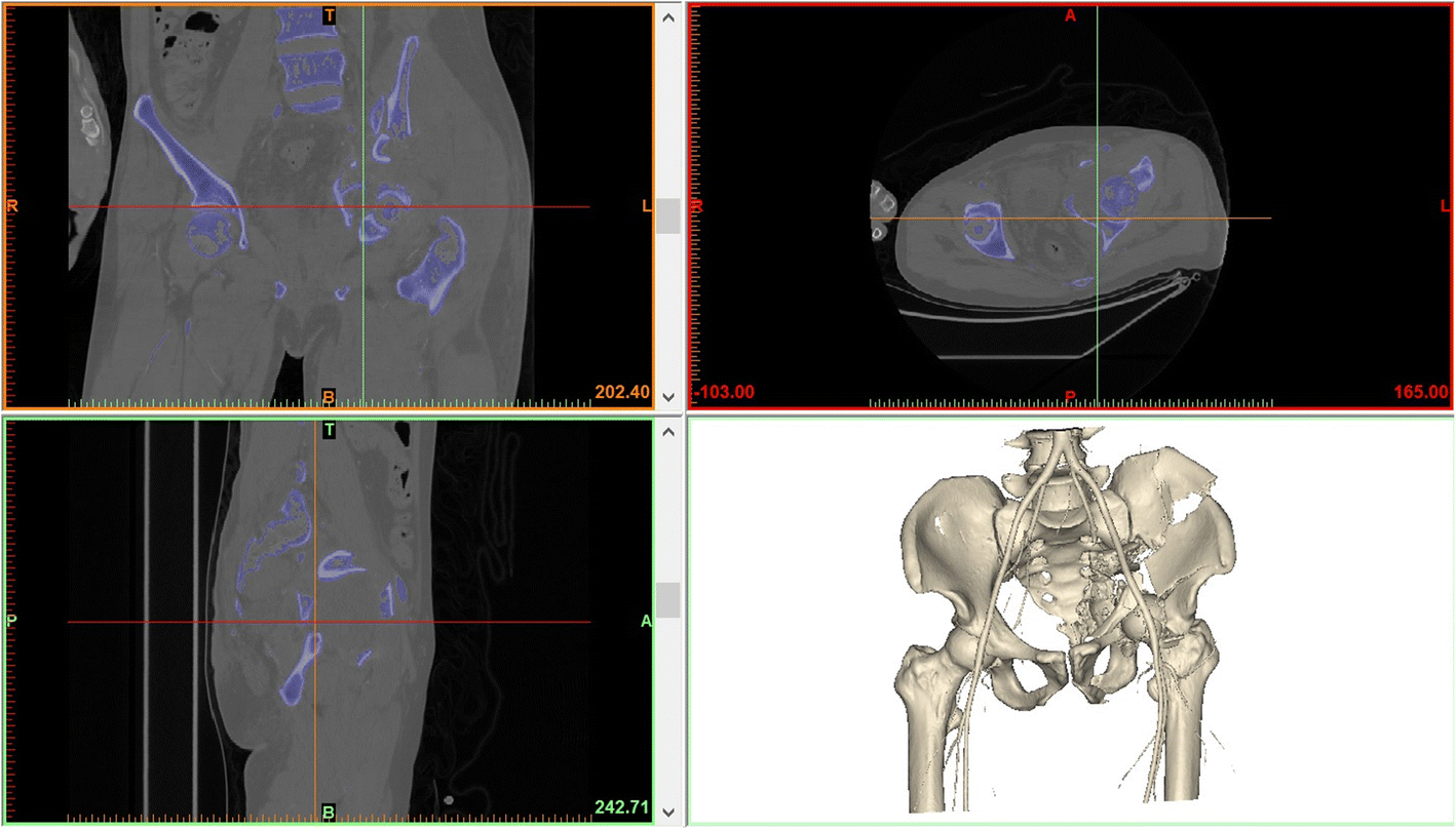 Fig. 2