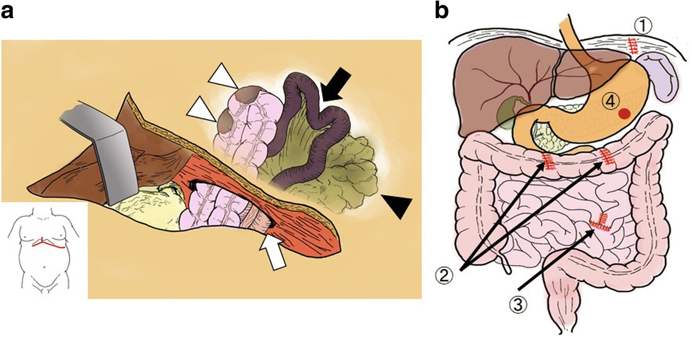 Fig. 2