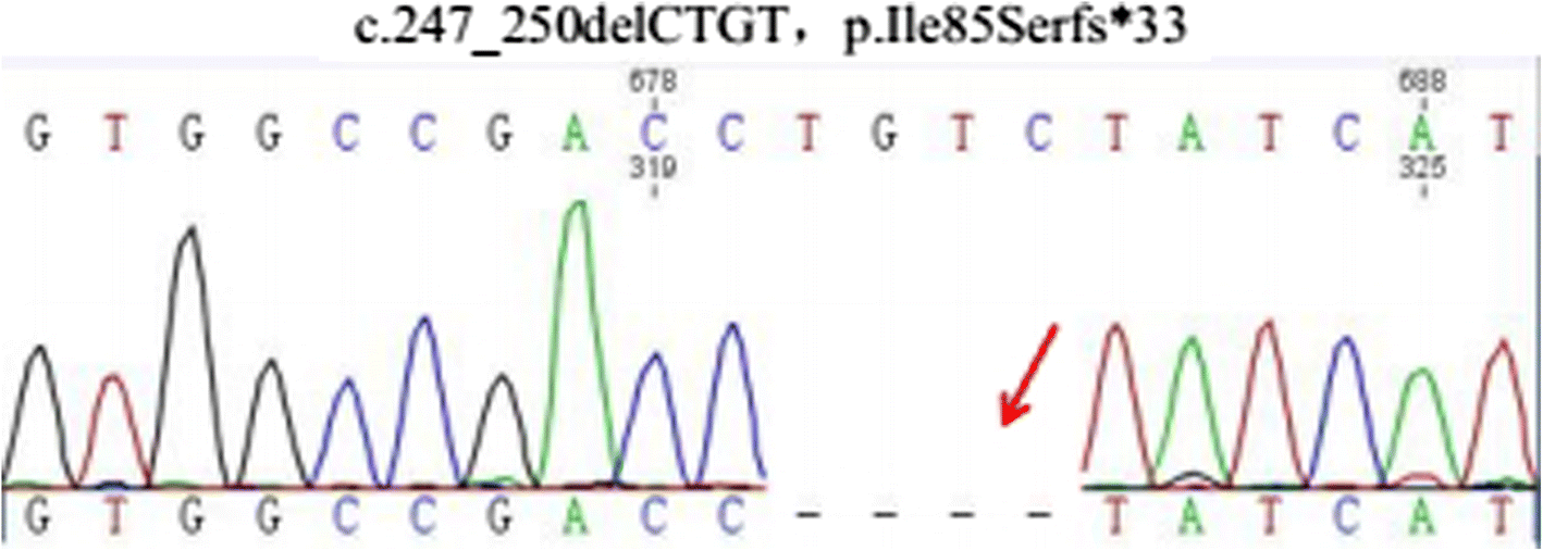 Fig. 3