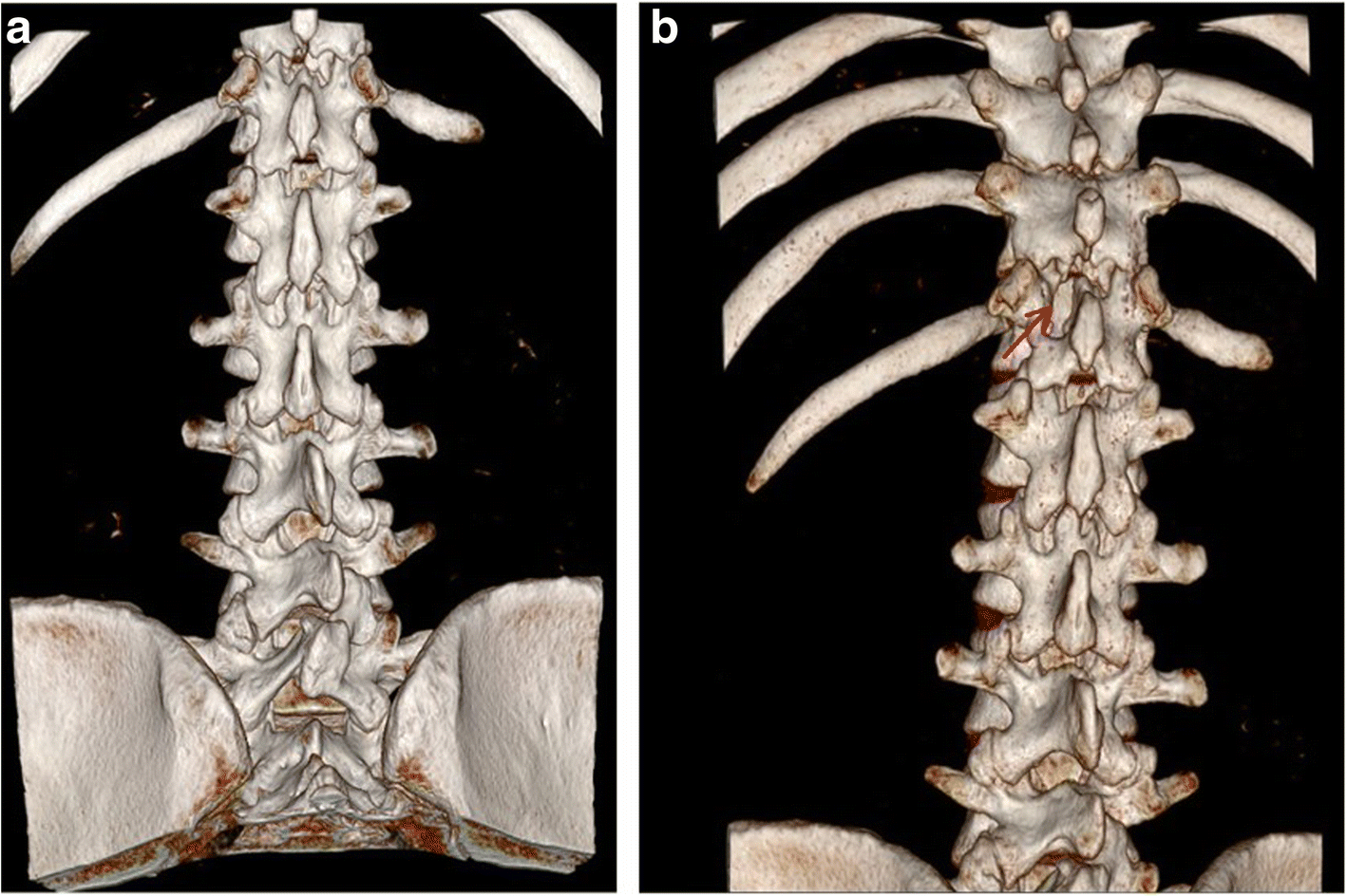 Fig. 11