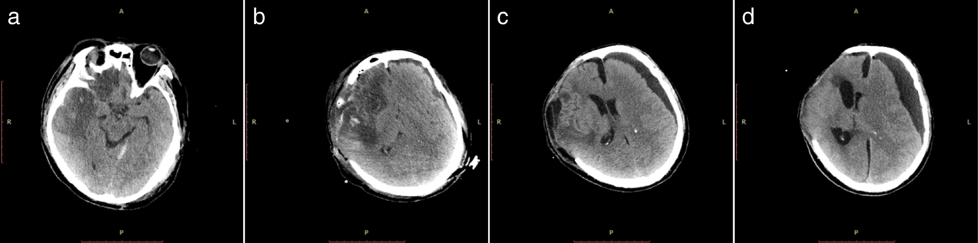 Fig. 2