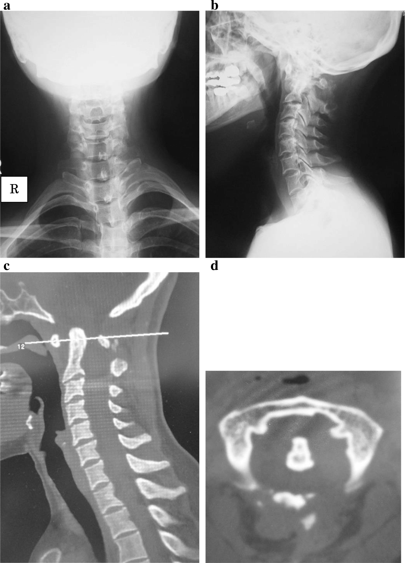 Fig. 3