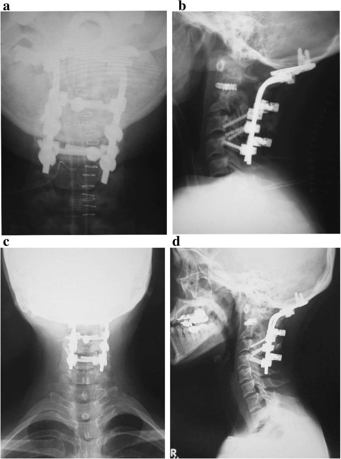 Fig. 4