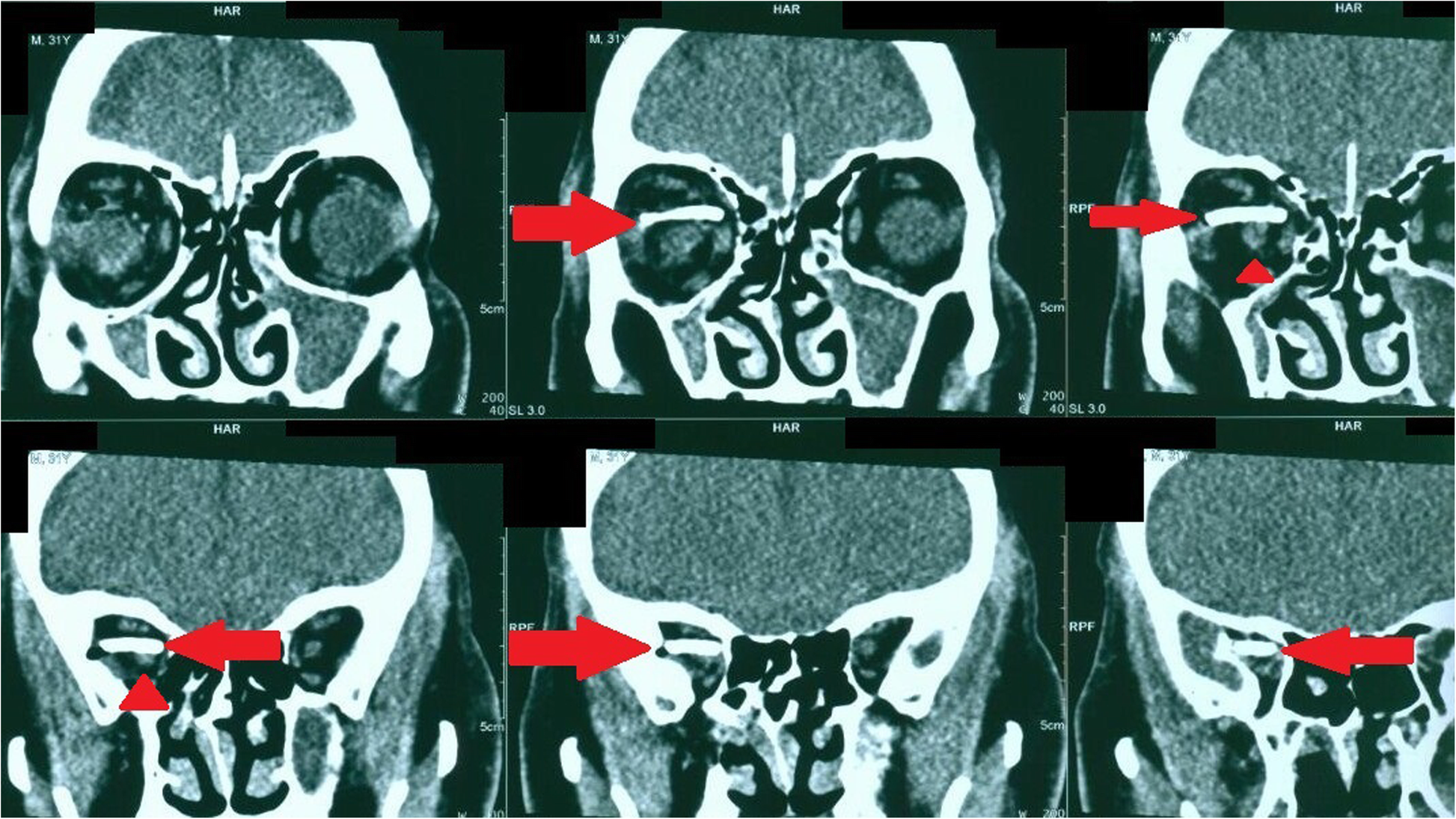 Fig. 3